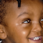 Rétinoblastome : le cancer qui rend les enfants aveugles - Mousso