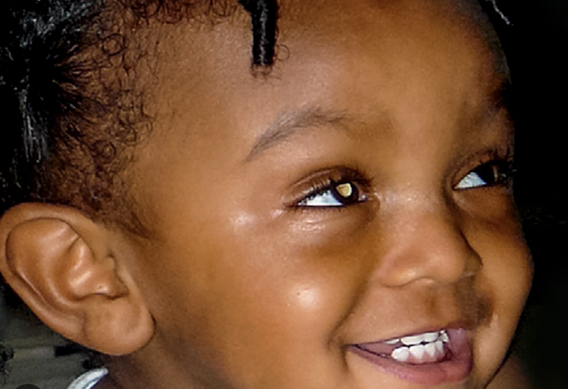 Rétinoblastome : le cancer qui rend les enfants aveugles - Mousso