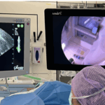 Les traitements du fibrome et l'accès aux soins - Mousso