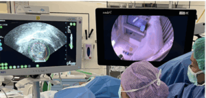 Les traitements du fibrome et l'accès aux soins - Mousso