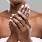 Dermatologie, autopsie des maladies de la peau - Mousso