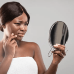 Dermatologie : quand les maladies de la peau hantent le quotidien des femmes - Mousso