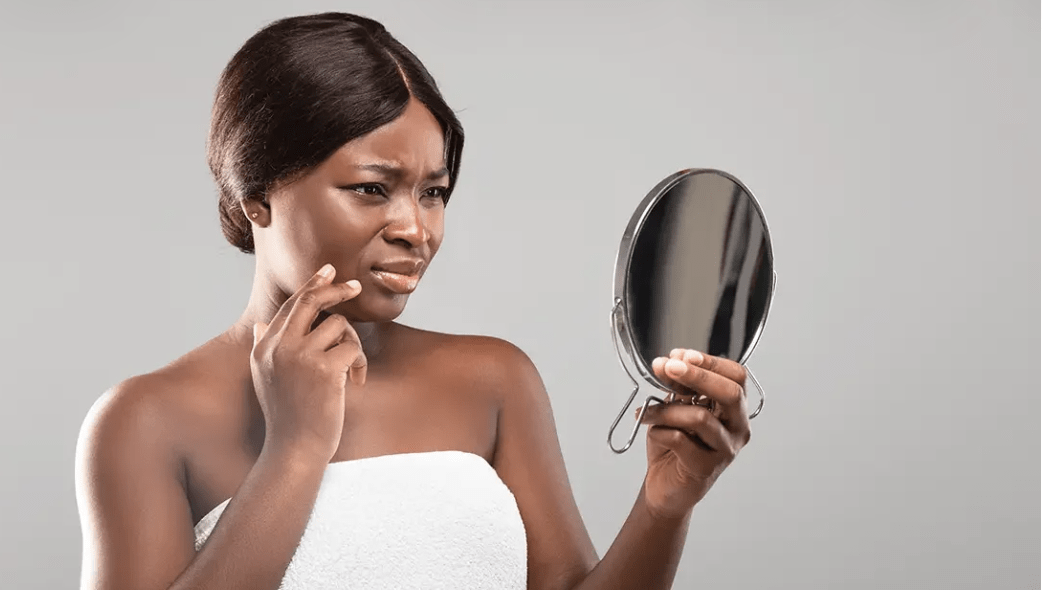 Dermatologie : quand les maladies de la peau hantent le quotidien des femmes - Mousso