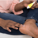 Pied diabétique : une amputation évitable à 80% - Mousso